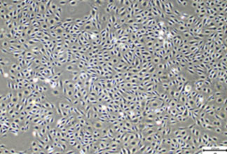 Umbilical cord-derived vascular endothelial cells 