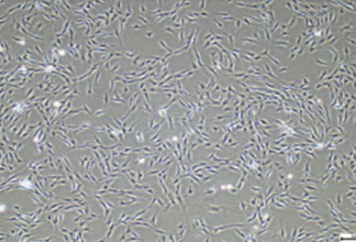 Human fibroblasts