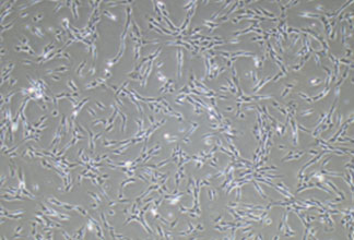 Periodontal ligament cells