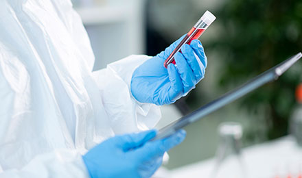 Allogeneic cell therapyagent with prediction/quality control possible