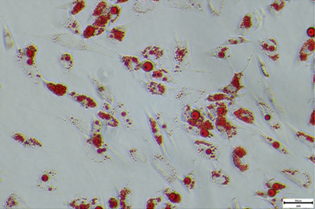 Adipogenic differentiation