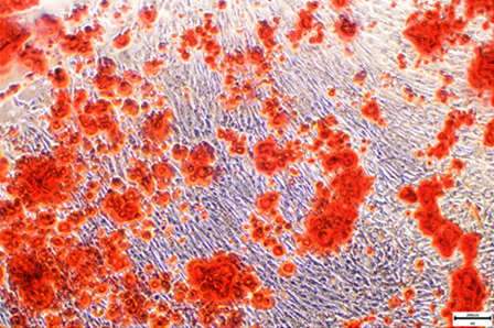 Osteogenic differentiation