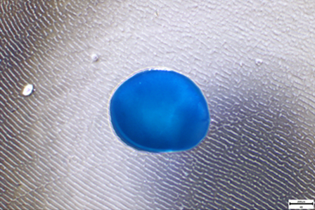 Chondrogenic differentiation